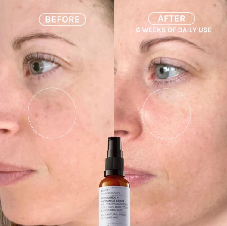 EVOLVE Resveratrol + Niacinamide Serum 10ml - Image 3
